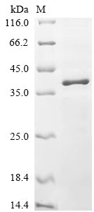 Recombinant Mouse 5-AMP-activated protein kinase catalytic subunit alpha-1 (Prkaa1), partial
