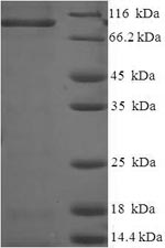 Recombinant Rat Caprin-1 (Caprin1)