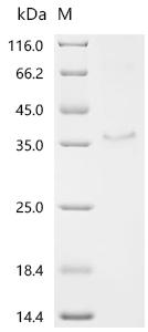 Recombinant Human Protein KPLCE (KPLCE)
