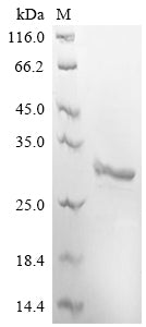 Recombinant Macaca fascicularis Ubiquitin carboxyl-terminal hydrolase isozyme L1 (UCHL1)