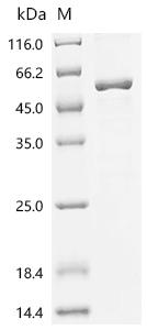 Recombinant Mouse 1,25-dihydroxyvitamin D(3) 24-hydroxylase, mitochondrial(Cyp24a1)