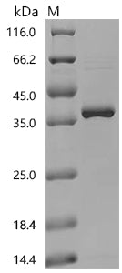 Recombinant Rat NAD-dependent protein deacylase sirtuin-5, mitochondrial (Sirt5)