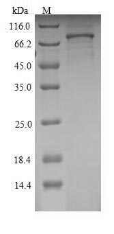 Recombinant Rat Semaphorin-3A (Sema3a)