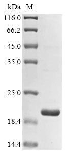 Recombinant Pan troglodytes Histone demethylase UTY (UTY), partial