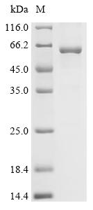 Recombinant Mouse Bile acid receptor (Nr1h4)