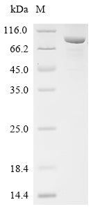 Recombinant Hepatitis B virus genotype D subtype ayw Protein P (P), partial, Biotinylated