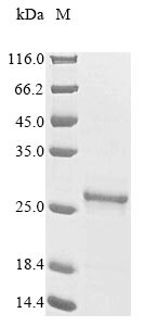 Recombinant Thermus thermophilus Ribonuclease HII (rnhB)