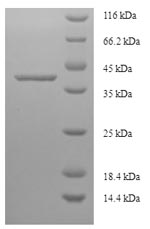 Recombinant Human La-related protein 1B (LARP1B)