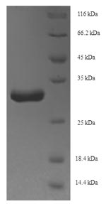Recombinant Staphylococcus aureus Holo-[acyl-carrier-protein] synthase (acpS)