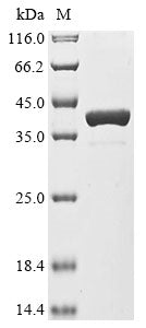 Recombinant Photobacterium profundum ATP synthase gamma chain 2 (atpG2)