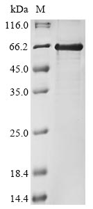 Recombinant Xenopus laevis Polyribonucleotide 5'-hydroxyl-kinase Clp1 (clp1)