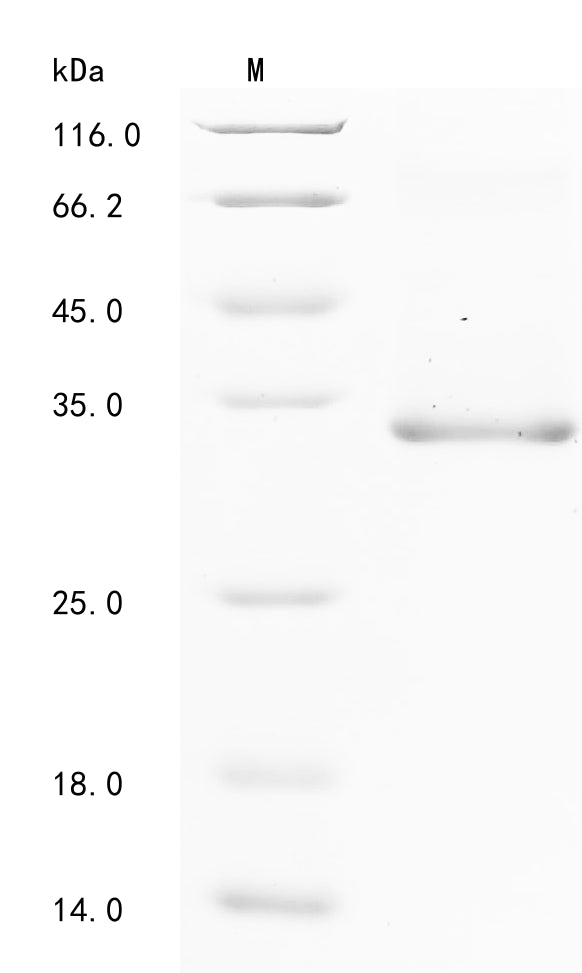 Recombinant Mouse A disintegrin and metalloproteinase with thrombospondin motifs 13 (Adamts13), partial
