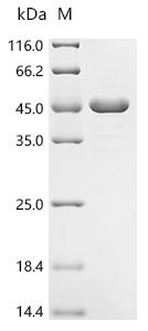 Recombinant Mycobacterium tuberculosis Transporter PPE51 (PPE51)