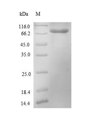 Recombinant Escherichia coli Probable phosphatidylethanolamine transferase Mcr-1 (mcr1)