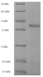 Recombinant Staphylococcus aureus Enoyl-[acyl-carrier-protein] reductase [NADPH] FabI (fabI)