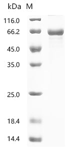 Recombinant Human E3 ubiquitin-protein ligase TRIM65 (TRIM65)