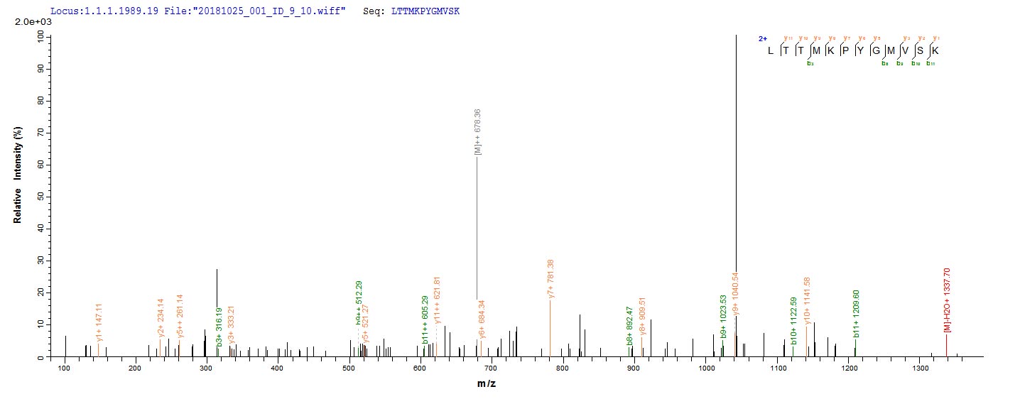 Recombinant Human metapneumovirus Matrix protein (M)