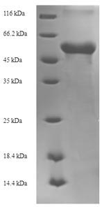 Recombinant Zaire ebolavirus Matrix protein VP40 (VP40)