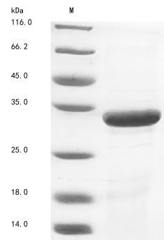Recombinant Zaire ebolavirus Matrix protein VP40 (VP40)