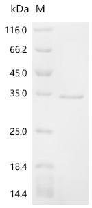 Recombinant Mouse Alpha-actinin-1 (Actn1), partial