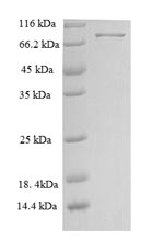 Recombinant Human Neuroepithelial cell-transforming gene 1 protein (NET1)