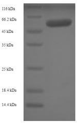 Recombinant Human Src kinase-associated phosphoprotein 1 (SKAP1)