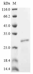 Recombinant Human Peroxisome proliferator-activated receptor gamma coactivator 1-beta (PPARGC1B), partial
