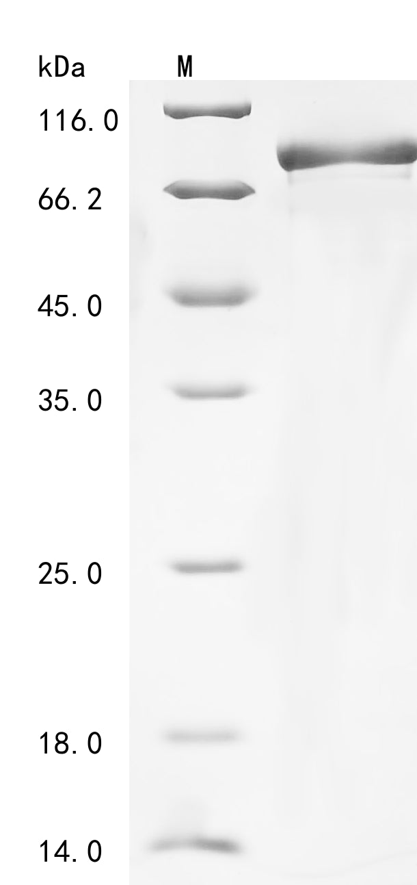 Recombinant Human Mitochondrial antiviral-signaling protein (MAVS), partial