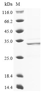 Recombinant Cat Troponin I, cardiac muscle (TNNI3)