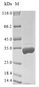 Recombinant Human Filamin-A-interacting protein 1 (FILIP1), partial