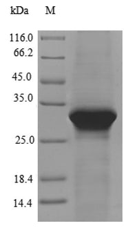 Recombinant Human Lipolysis-stimulated lipoprotein receptor (LSR), partial