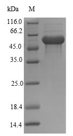 Recombinant Mouse Thioredoxin-interacting protein (Txnip)
