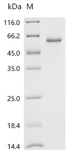Recombinant Mouse Thioredoxin-interacting protein (Txnip)