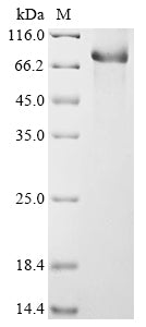 Recombinant Mouse Complement C1s-1 subcomponent (C1s1)