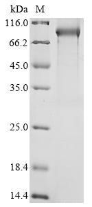 Recombinant Mouse Complement C1s-B subcomponent (C1sb)