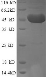 Recombinant Human m7GpppN-mRNA hydrolase (DCP2)
