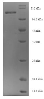 Recombinant Mouse Oxysterol-binding protein-related protein 11 (Osbpl11)