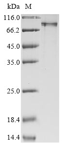 Recombinant Human E3 ubiquitin-protein ligase RNF168 (RNF168)