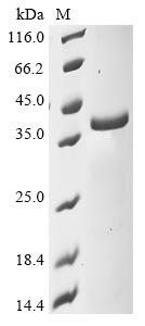 Recombinant Mouse NAD-dependent protein deacylase sirtuin-5, mitochondrial (Sirt5)