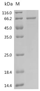 Recombinant Human Extracellular serine/threonine protein kinase FAM20C (FAM20C)