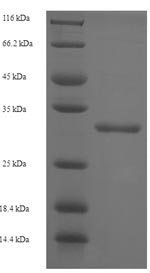Recombinant Human CMP-N-acetylneuraminate-poly-alpha-2,8-sialyltransferase (ST8SIA4)