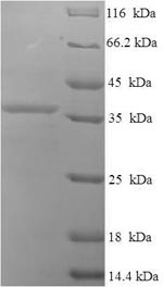 Recombinant Human Uncharacterized protein C9orf163 (C9orf163)