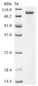 Recombinant Human Kelch repeat and BTB domain-containing protein 7 (KBTBD7)