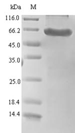 Recombinant Human Serine protease HTRA1 (HTRA1)