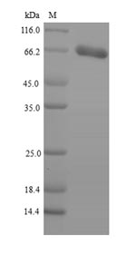 Recombinant Human Patatin-like phospholipase domain-containing protein 2 (PNPLA2)