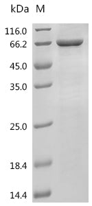 Recombinant Human Patatin-like phospholipase domain-containing protein 2 (PNPLA2)