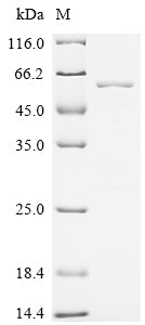 Recombinant Human Serine/threonine-protein phosphatase PGAM5, mitochondrial (PGAM5), partial