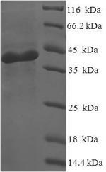 Recombinant Human Nicotinamide mononucleotide adenylyltransferase 3 (NMNAT3)