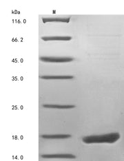 Recombinant Human Fragile X mental retardation 1 neighbor protein (FMR1NB), partial