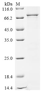 Recombinant Human Methyltransferase-like protein 25 (METTL25)